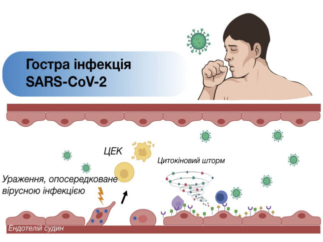 Ендотеліїт як важливий чинник Long Covid і шляхи медикаментозної корекції