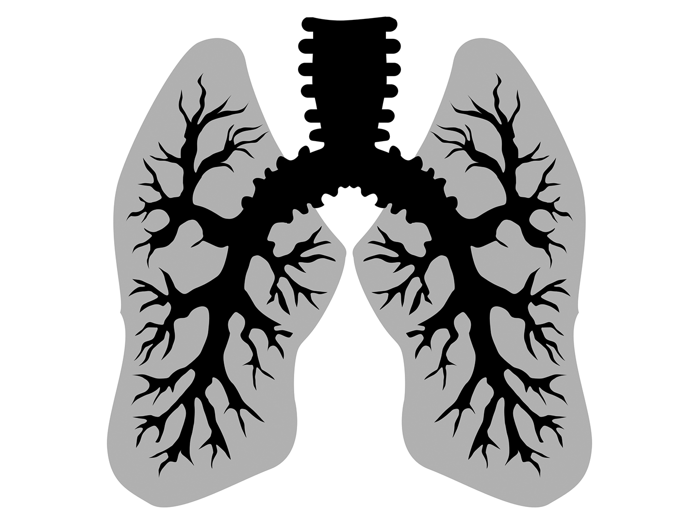 Factors related to the improvement of the right ventricular function in patients with pulmonary embolism at short-term follow-up